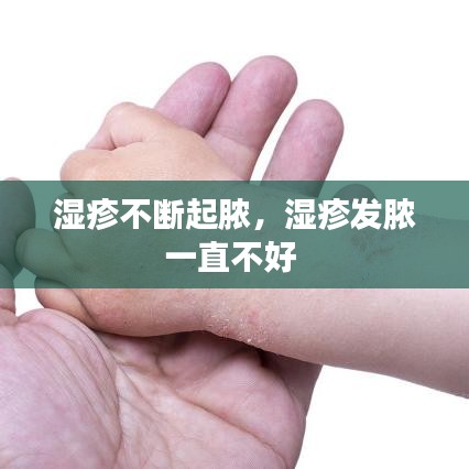 湿疹不断起脓，湿疹发脓一直不好 