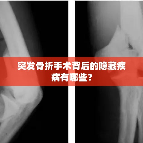 突发骨折手术背后的隐藏疾病有哪些?