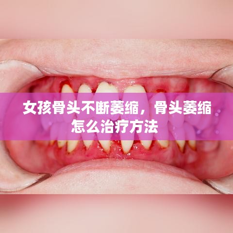 女孩骨头不断萎缩,骨头萎缩怎么治疗方法