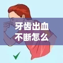 牙齿出血不断怎么弄好，牙齿出血不停怎么止血 