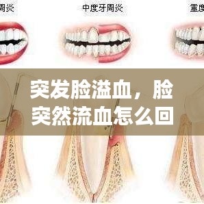 突发脸溢血，脸突然流血怎么回事 