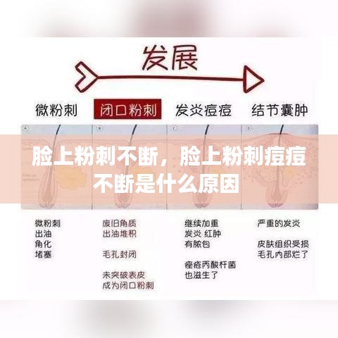 脸上粉刺不断,脸上粉刺痘痘不断是什么原因