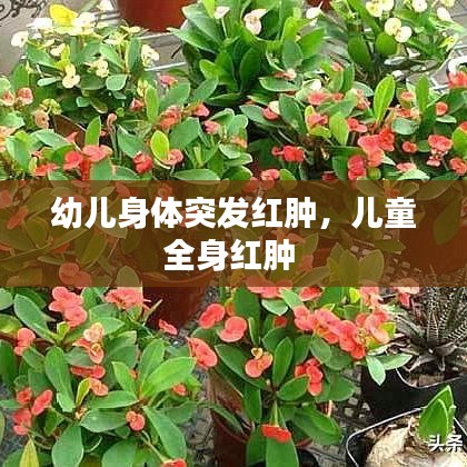 幼儿身体突发红肿，儿童全身红肿 