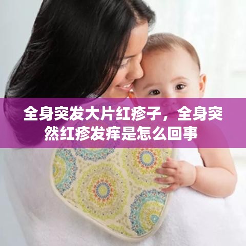 全身突发大片红疹子，全身突然红疹发痒是怎么回事 