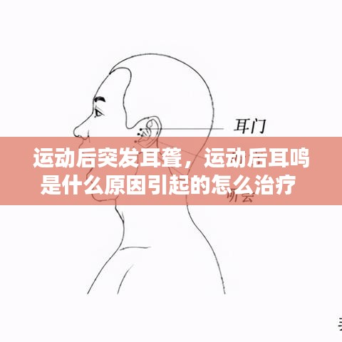 运动后突发耳聋，运动后耳鸣是什么原因引起的怎么治疗 