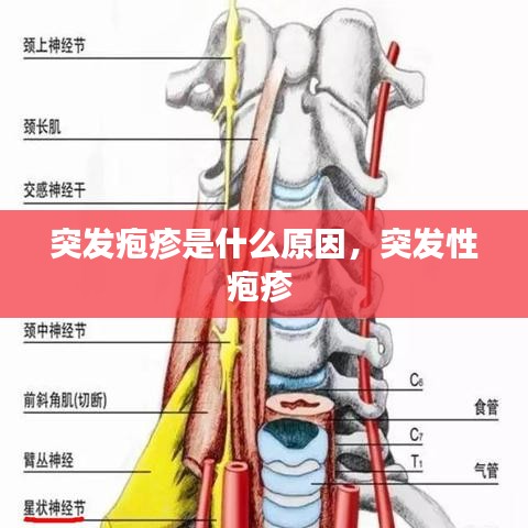 突发疱疹是什么原因，突发性疱疹 