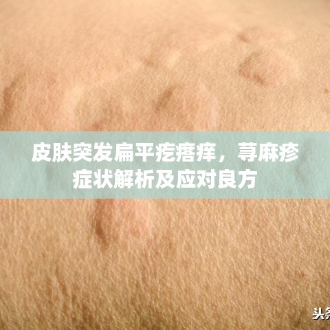 皮肤突发扁平疙瘩痒,荨麻疹症状解析及应对良方