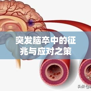 突发脑卒中的征兆与应对之策