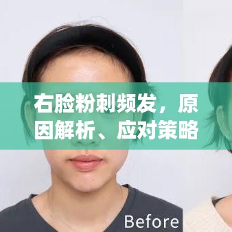 右脸粉刺频发，原因解析、应对策略与日常护理方法
