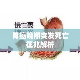 胃癌晚期突发死亡征兆解析