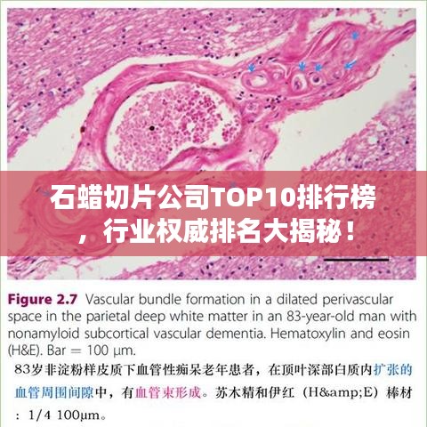 石蜡切片公司TOP10排行榜，行业权威排名大揭秘！