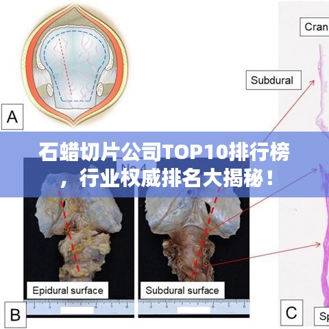 石蜡切片公司TOP10排行榜,行业权威排名大揭秘!