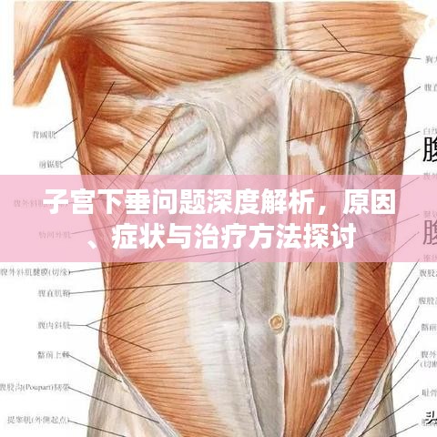 子宫下垂问题深度解析，原因、症状与治疗方法探讨