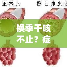 换季干咳不止？症状解析与应对方案全攻略